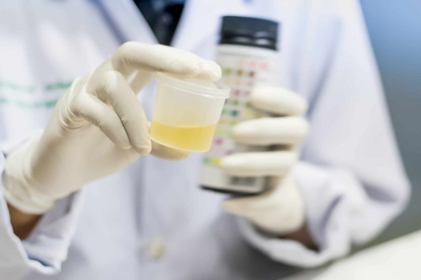 Best synthetic urine